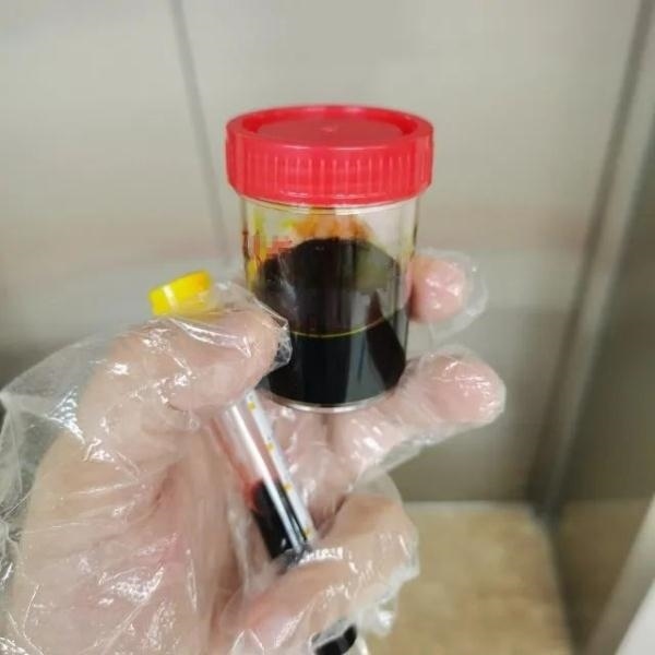 急性肝衰竭！兩兄弟誤吃這種菌 專家提醒