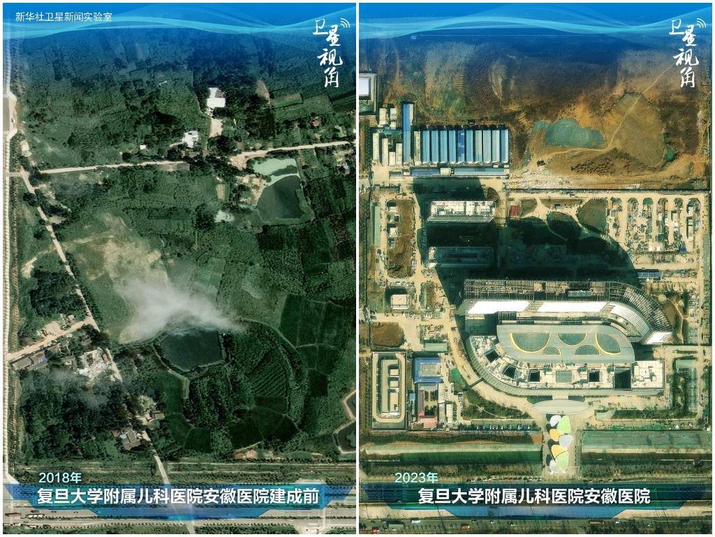 2023年與2018年相比，復(fù)旦大學(xué)附屬兒科醫(yī)院安徽醫(yī)院從一片荒地到建成投用。該項(xiàng)目是安徽省在長三角一體化高質(zhì)量發(fā)展衛(wèi)生健康領(lǐng)域的重大項(xiàng)目，也是安徽首批落地的國家區(qū)域醫(yī)療中心。